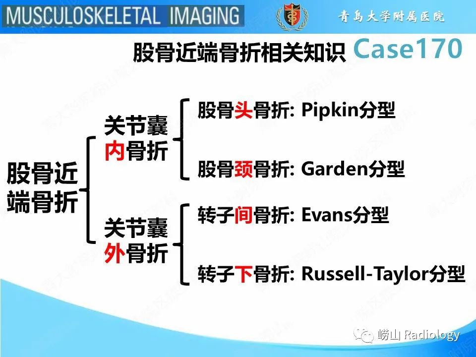 【PPT】股骨术后并发症-18