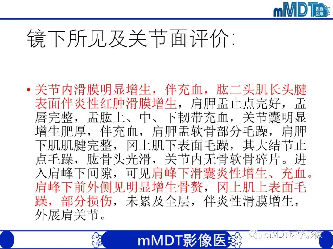 【PPT】肩关节撞击综合征-90