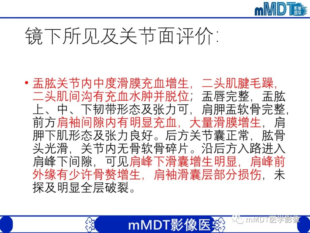 【PPT】肩关节撞击综合征-98