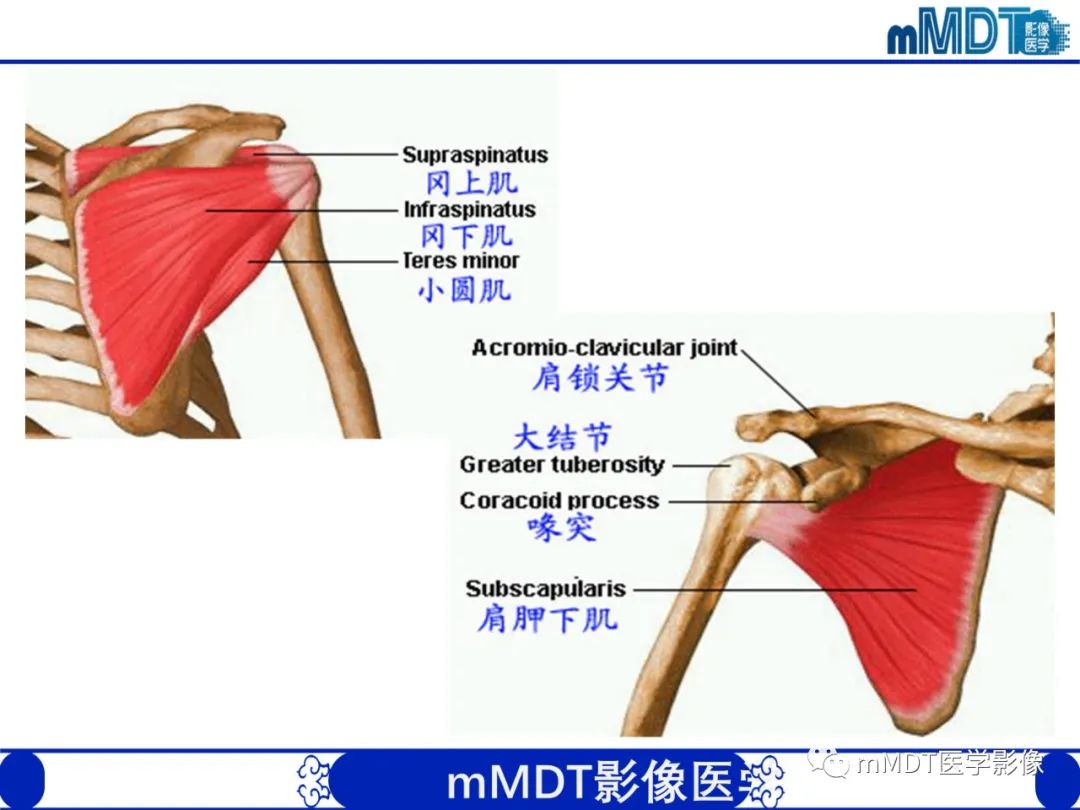 【PPT】肩关节撞击综合征-19