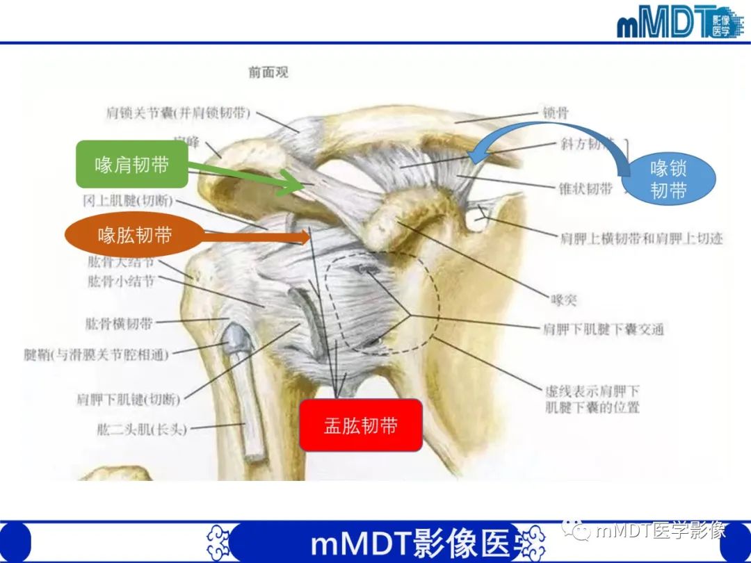【PPT】肩关节撞击综合征-13