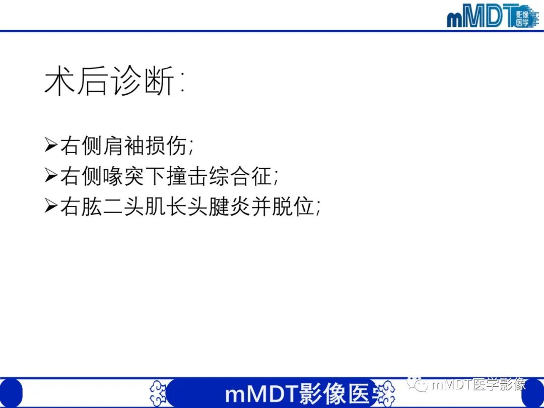 【PPT】肩关节撞击综合征-99