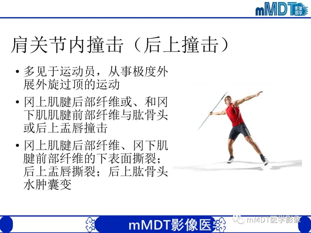 【PPT】肩关节撞击综合征-67