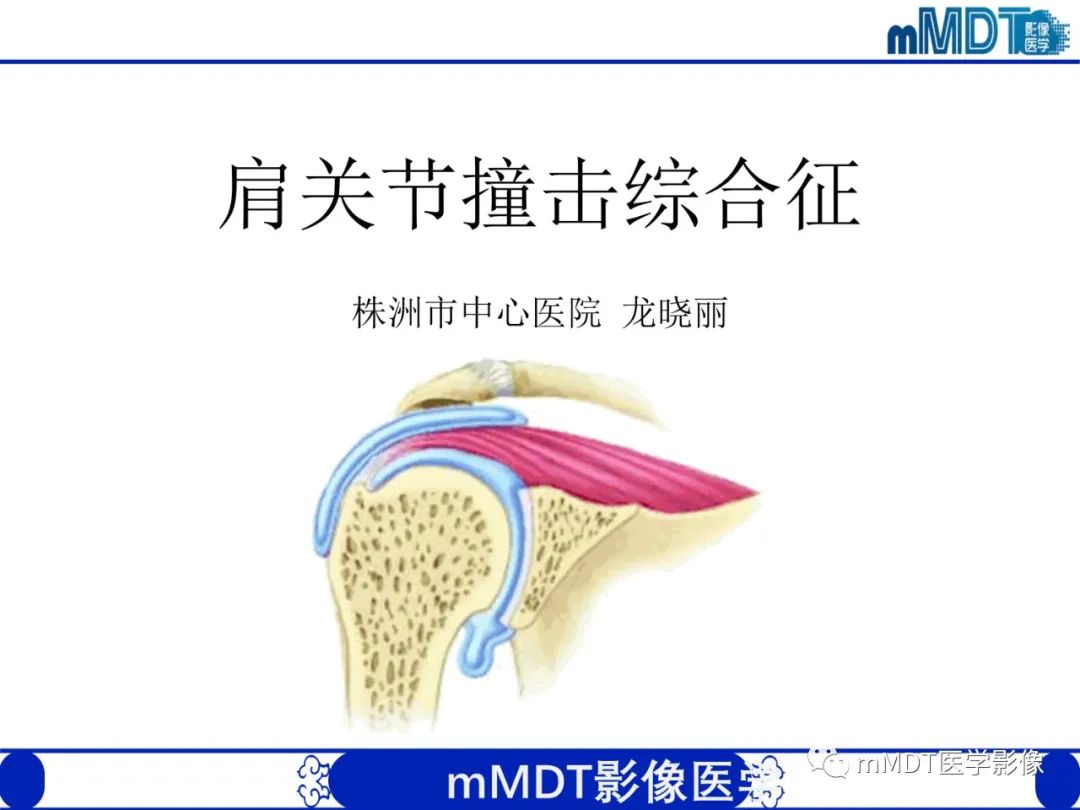 【PPT】肩关节撞击综合征-7