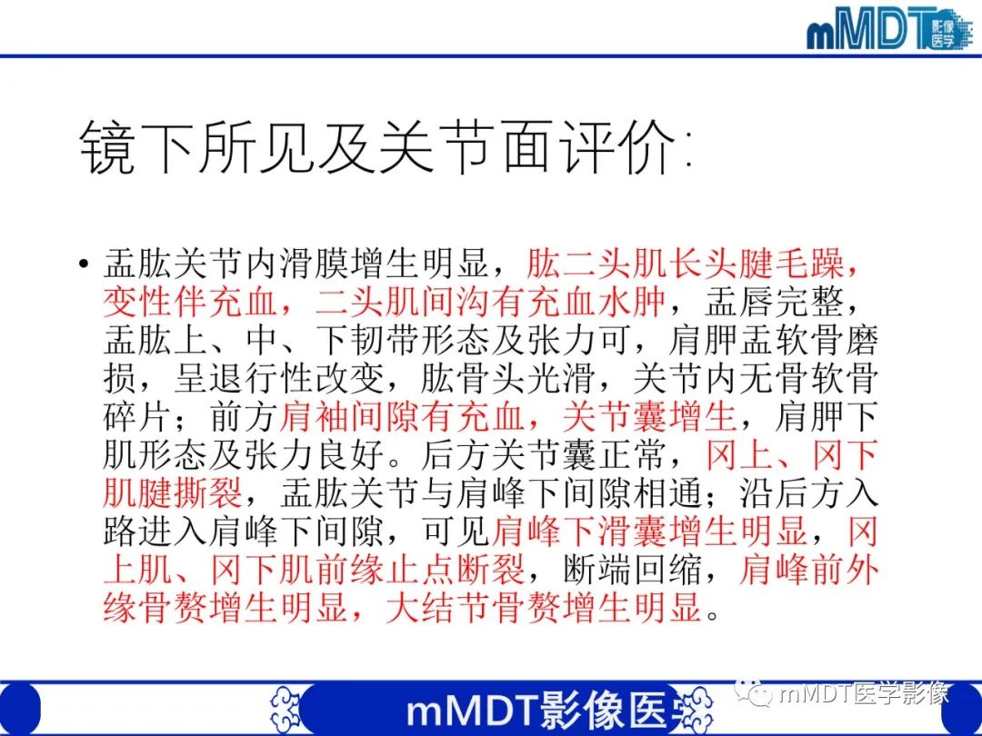 【PPT】肩关节撞击综合征-82