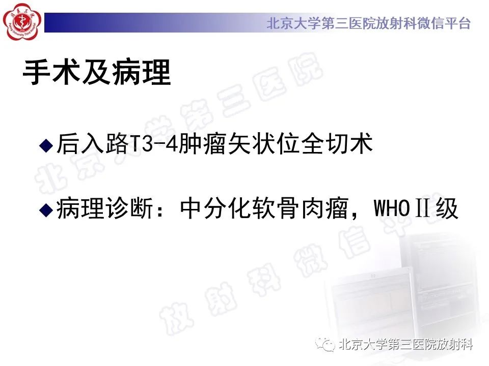 【PPT】脊柱软骨肉瘤-14