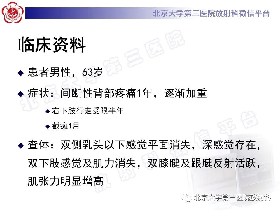 【PPT】脊柱软骨肉瘤-2