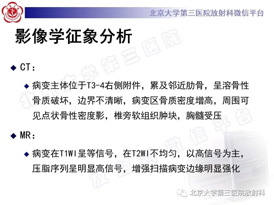 【PPT】脊柱软骨肉瘤-11