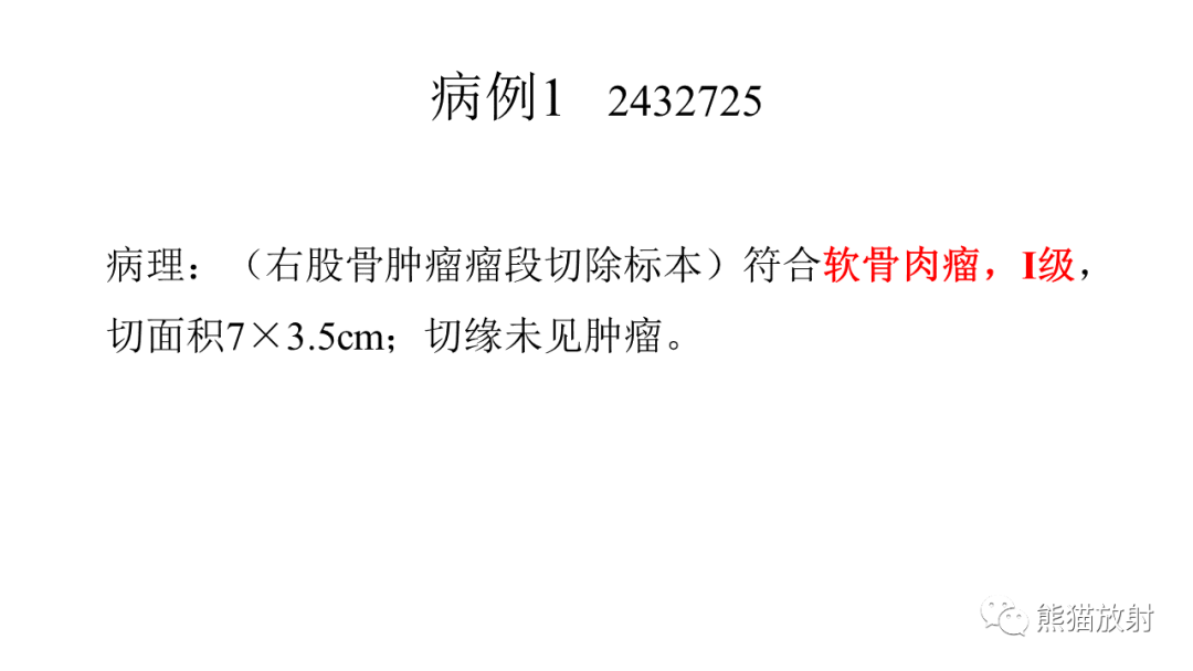 【病例】软骨肉瘤I级 VS 去分化软骨肉瘤-24