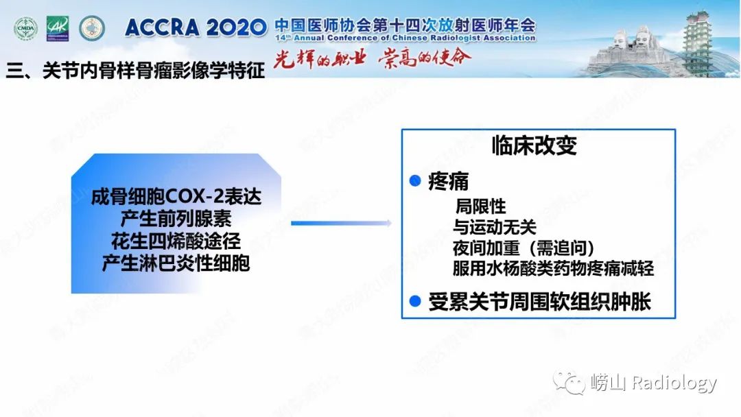 【PPT】关节内骨样骨瘤的影像诊断-30