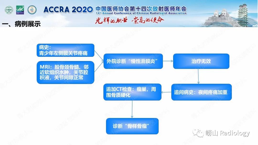 【PPT】关节内骨样骨瘤的影像诊断-12