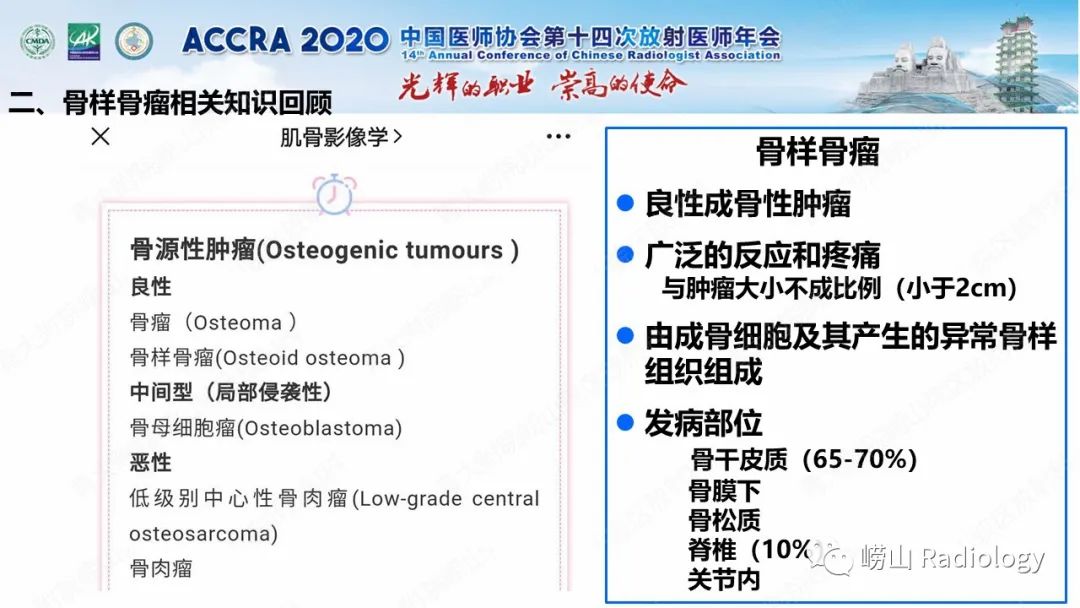 【PPT】关节内骨样骨瘤的影像诊断-20
