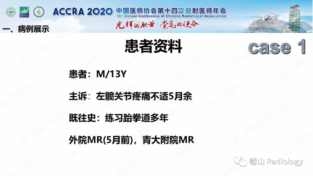 【PPT】关节内骨样骨瘤的影像诊断-3