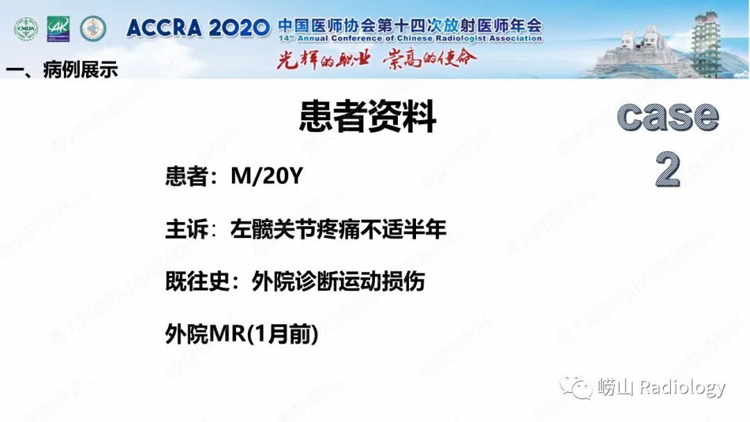 【PPT】关节内骨样骨瘤的影像诊断-13