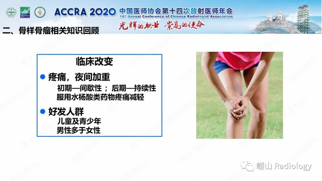 【PPT】关节内骨样骨瘤的影像诊断-22