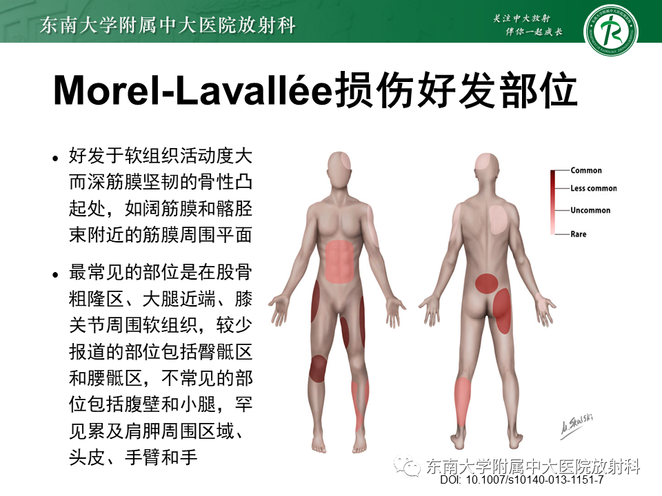 【PPT】髂胫束相关损伤-16