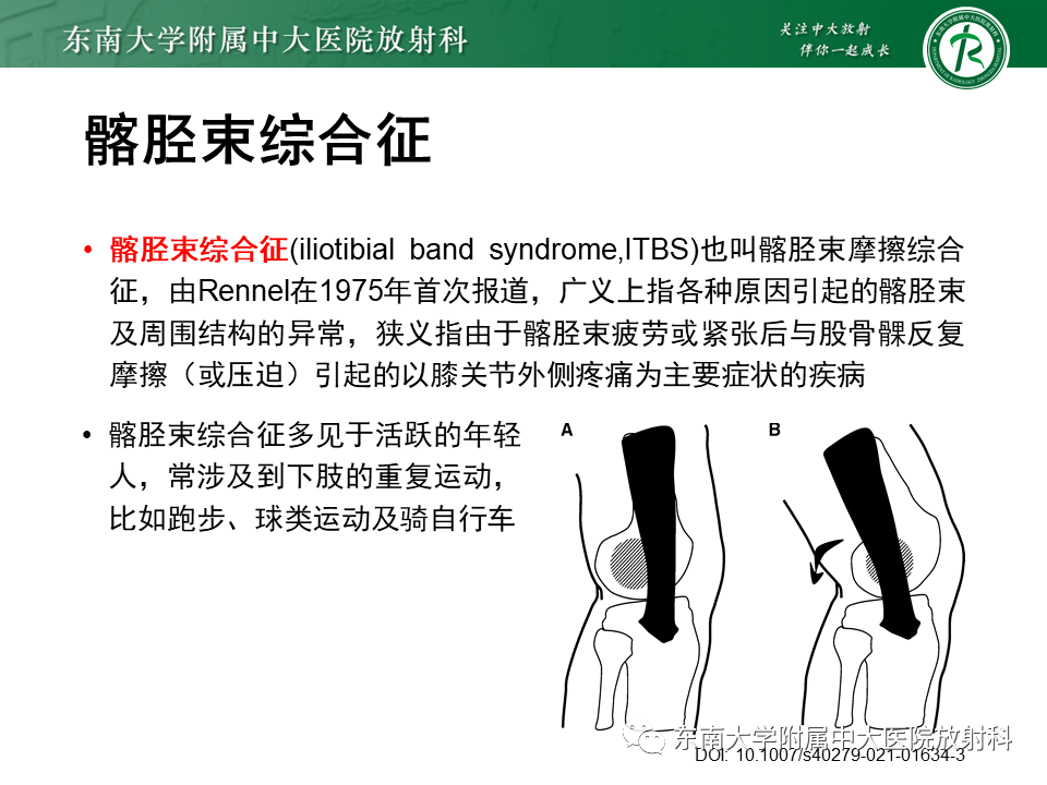 【PPT】髂胫束相关损伤-11