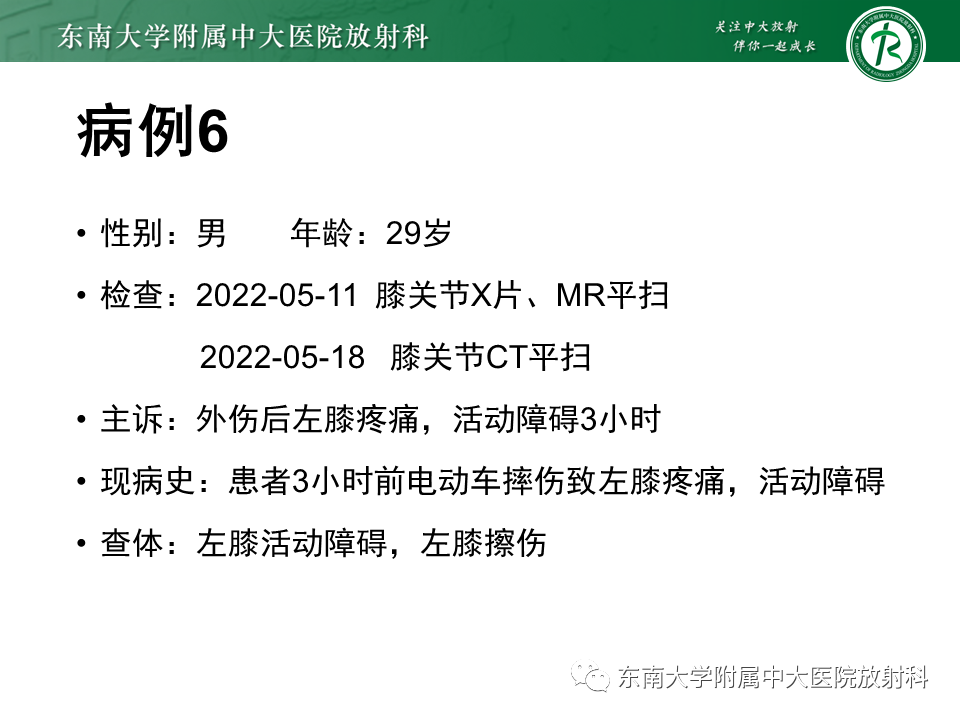 【PPT】髂胫束相关损伤-50