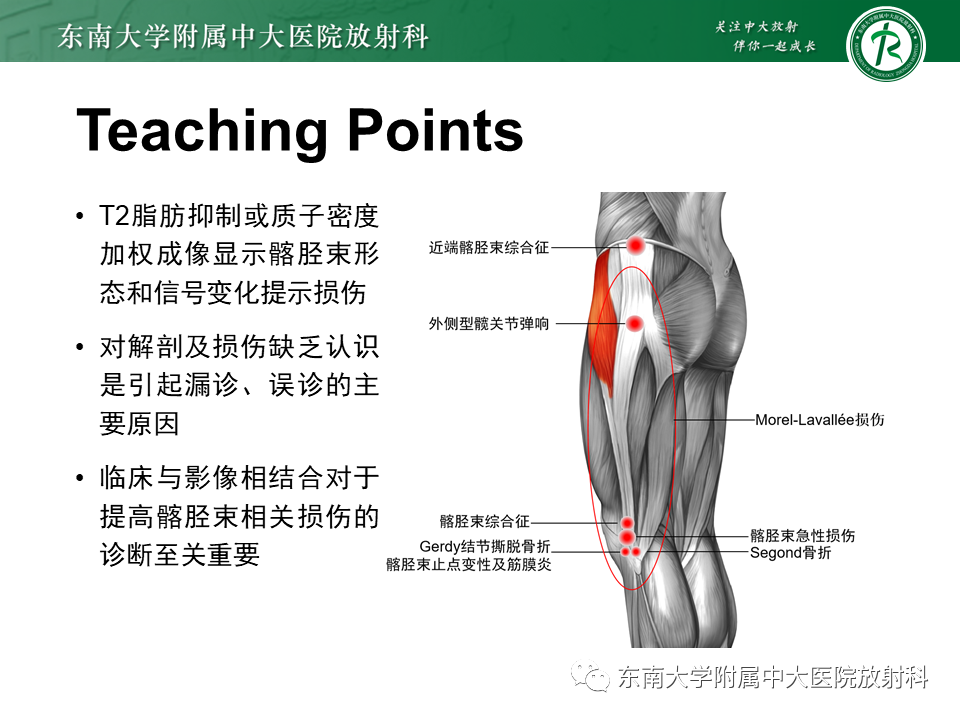 【PPT】髂胫束相关损伤-53