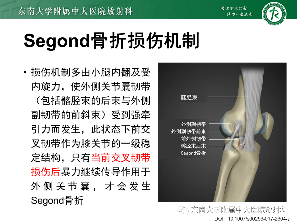 【PPT】髂胫束相关损伤-48