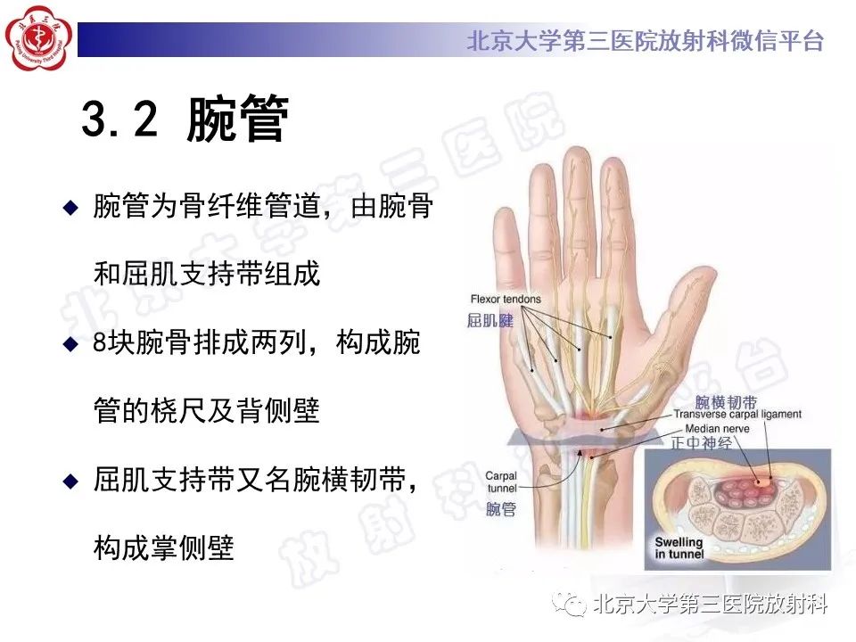 【PPT】腕管综合征-13