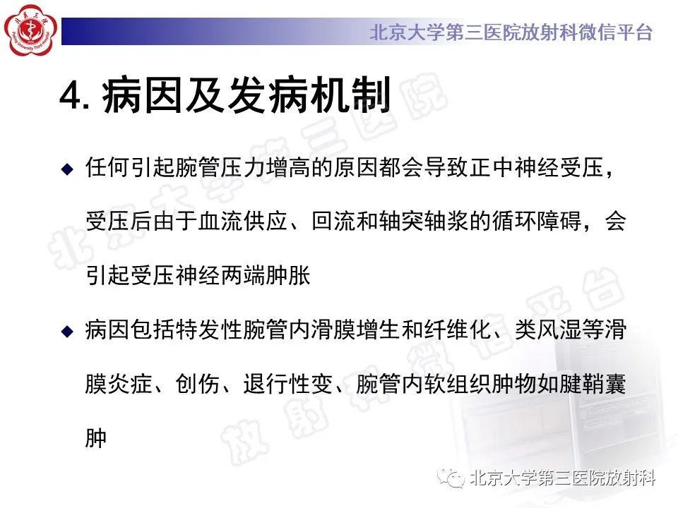 【PPT】腕管综合征-16