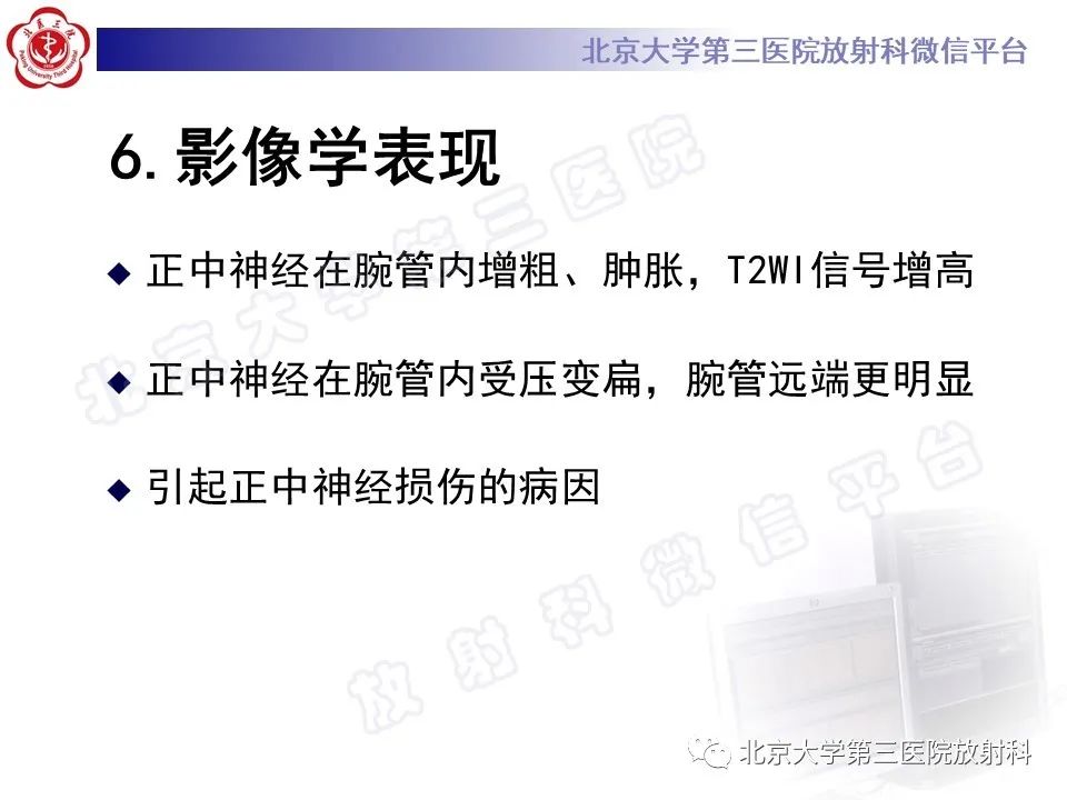 【PPT】腕管综合征-1