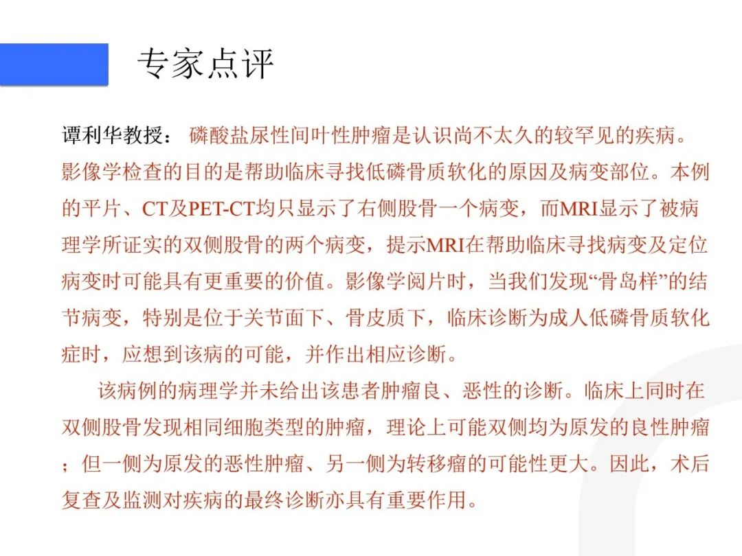 【病例】磷酸盐尿性间叶性肿瘤1例影像学诊断思路-34