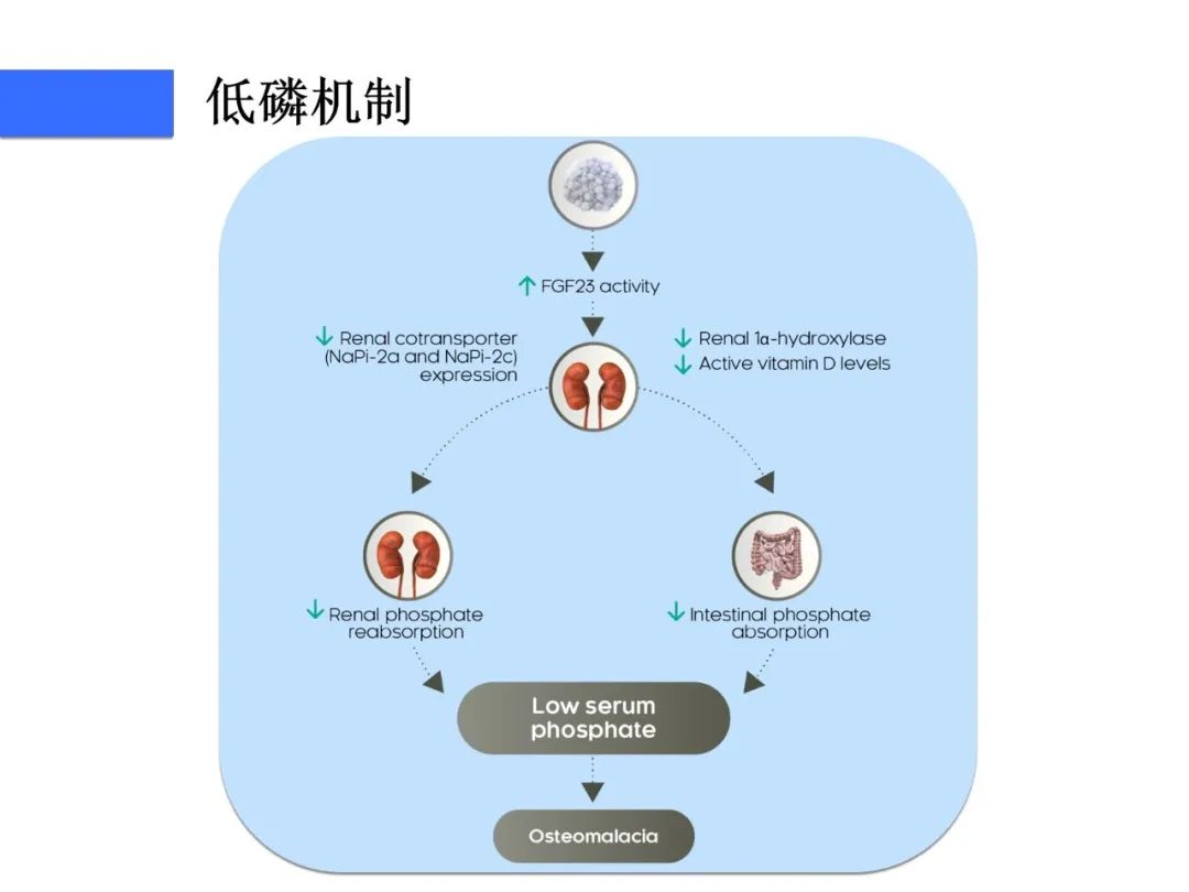 【病例】磷酸盐尿性间叶性肿瘤1例影像学诊断思路-15