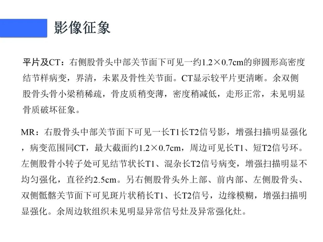 【病例】磷酸盐尿性间叶性肿瘤1例影像学诊断思路-8