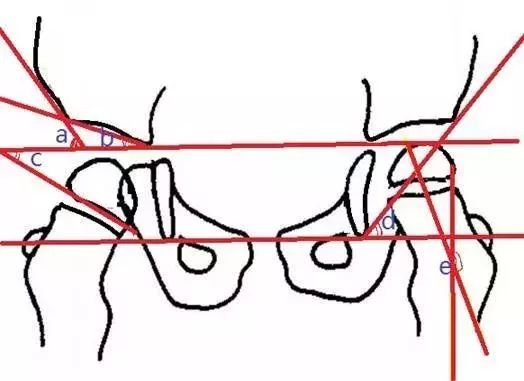 骨盆X线解剖详解-5
