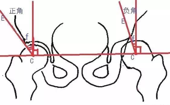 骨盆X线解剖详解-6