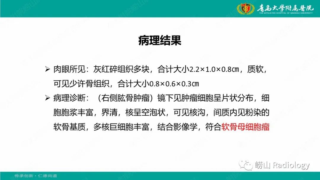 【病例】肱骨干骺端软骨母细胞瘤1例CT及MR-16