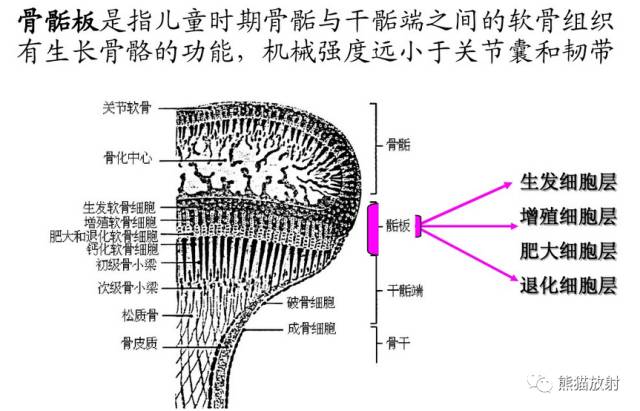 骨骺损伤的分型及影像表现-2