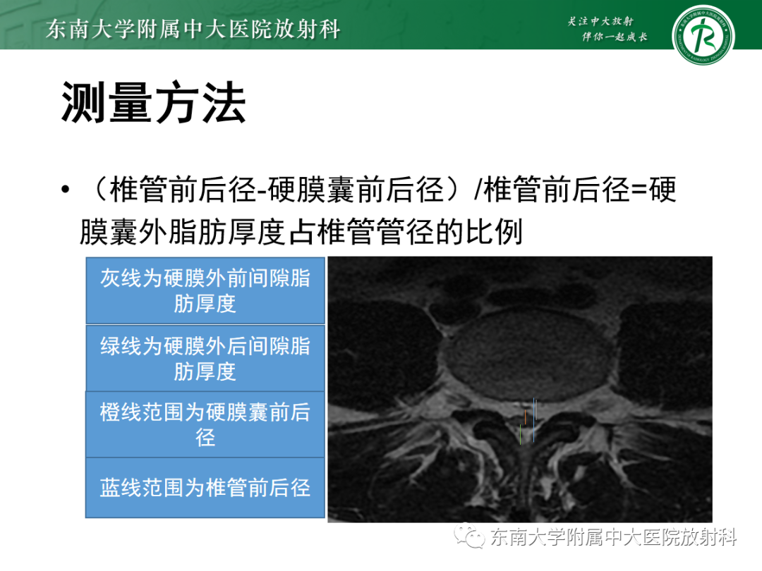 【PPT】椎管内硬膜外脂肪增多症-7