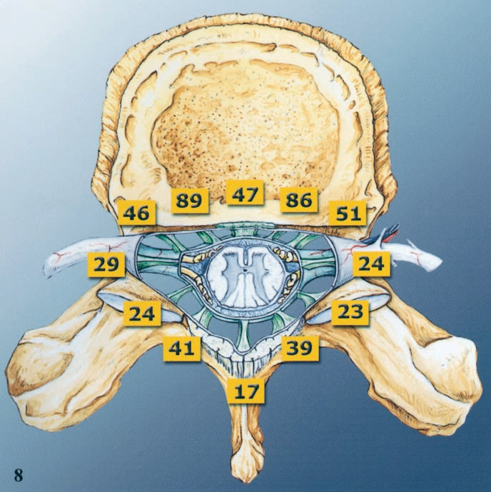 常见易忽略的疾病—椎管内硬膜外脂肪增多症-15