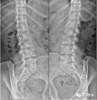 狗戴项圈征