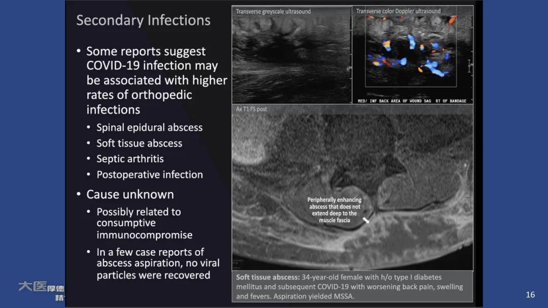 【PPT】COVID-19 的肌肉骨骼表现：对目前所描述的多模态成像及临床症状的图片综述​-14