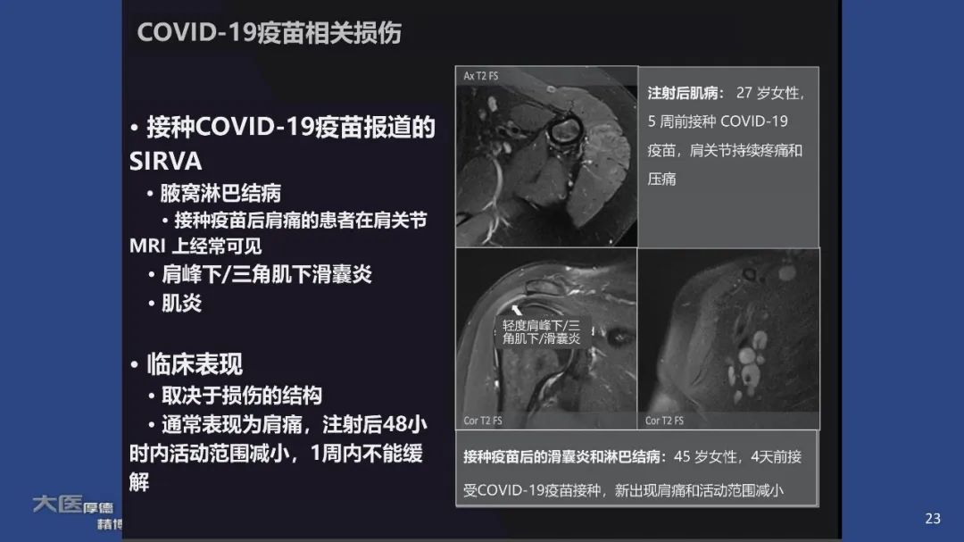 【PPT】COVID-19 的肌肉骨骼表现：对目前所描述的多模态成像及临床症状的图片综述​-21