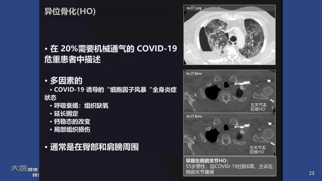 【PPT】COVID-19 的肌肉骨骼表现：对目前所描述的多模态成像及临床症状的图片综述​-23
