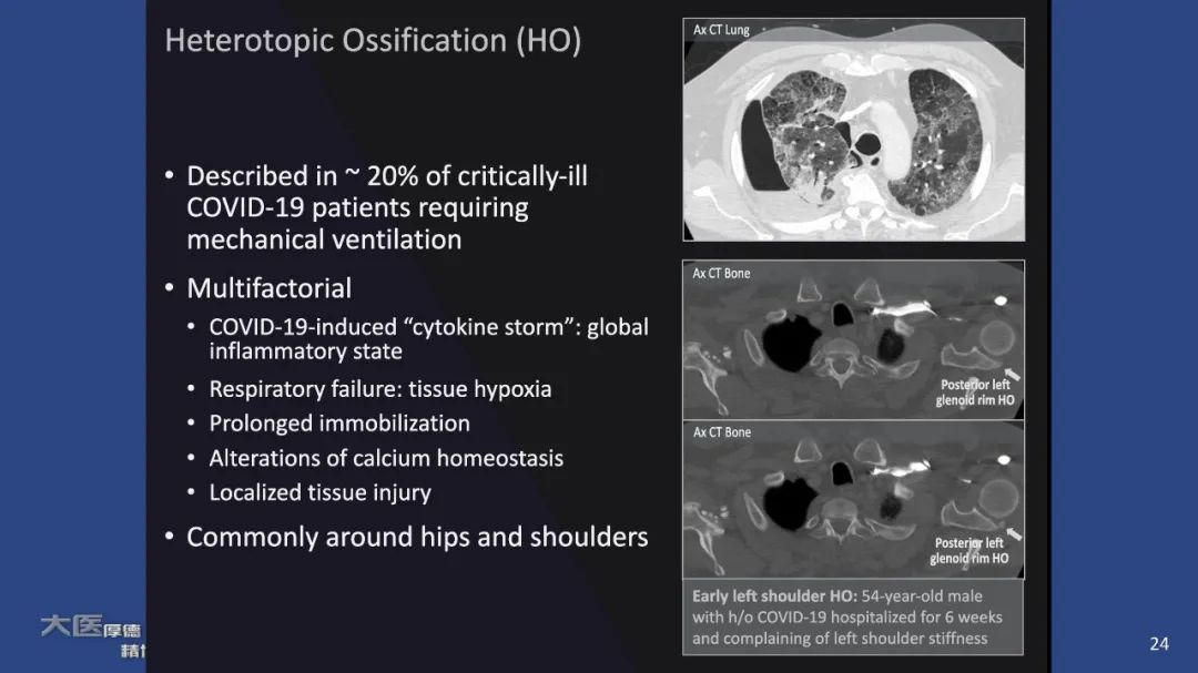 【PPT】COVID-19 的肌肉骨骼表现：对目前所描述的多模态成像及临床症状的图片综述​-24