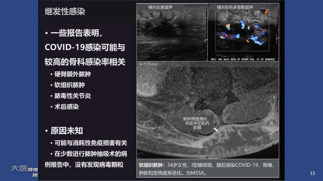 【PPT】COVID-19 的肌肉骨骼表现：对目前所描述的多模态成像及临床症状的图片综述​-13