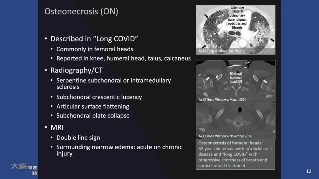 【PPT】COVID-19 的肌肉骨骼表现：对目前所描述的多模态成像及临床症状的图片综述​-12