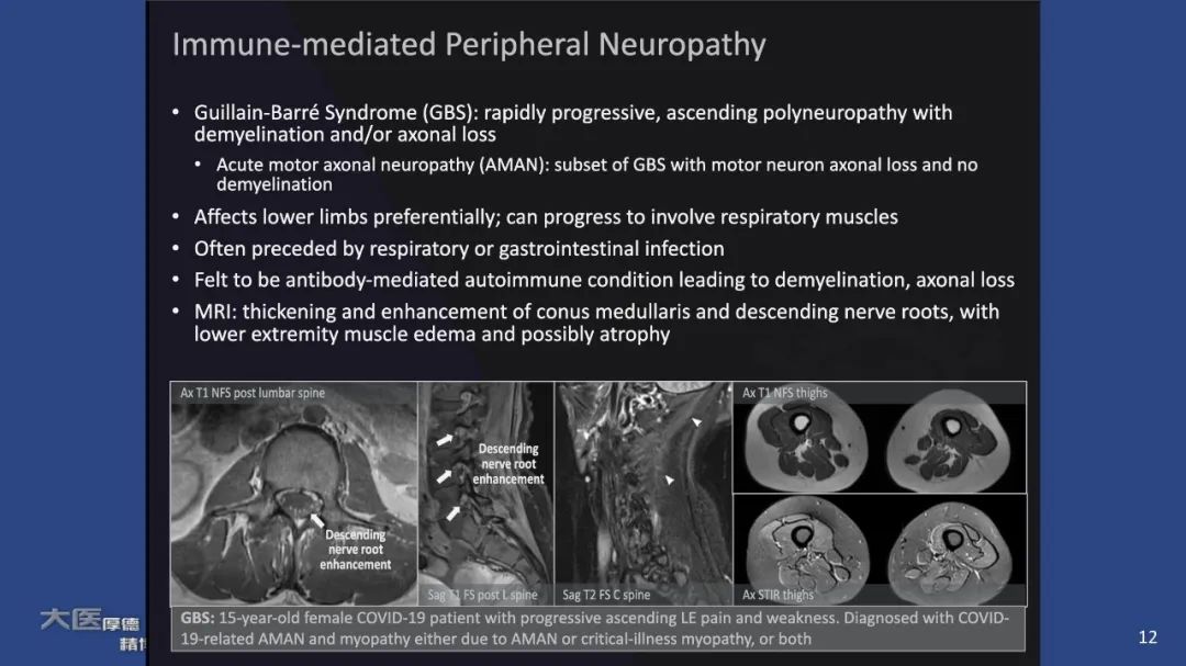 【PPT】COVID-19 的肌肉骨骼表现：对目前所描述的多模态成像及临床症状的图片综述​-10