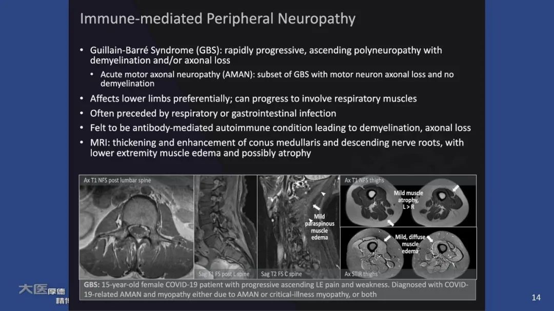 【PPT】COVID-19 的肌肉骨骼表现：对目前所描述的多模态成像及临床症状的图片综述​-12