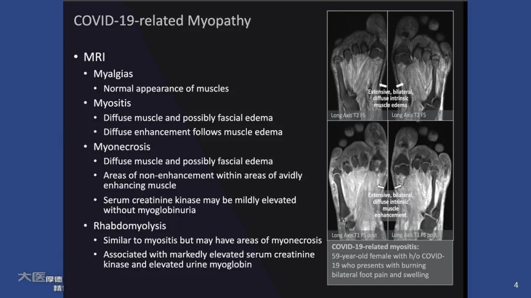 【PPT】COVID-19 的肌肉骨骼表现：对目前所描述的多模态成像及临床症状的图片综述​-2