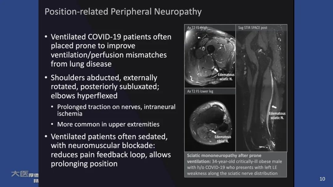 【PPT】COVID-19 的肌肉骨骼表现：对目前所描述的多模态成像及临床症状的图片综述​-8