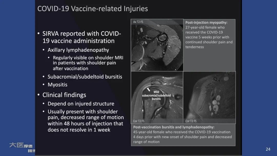 【PPT】COVID-19 的肌肉骨骼表现：对目前所描述的多模态成像及临床症状的图片综述​-22