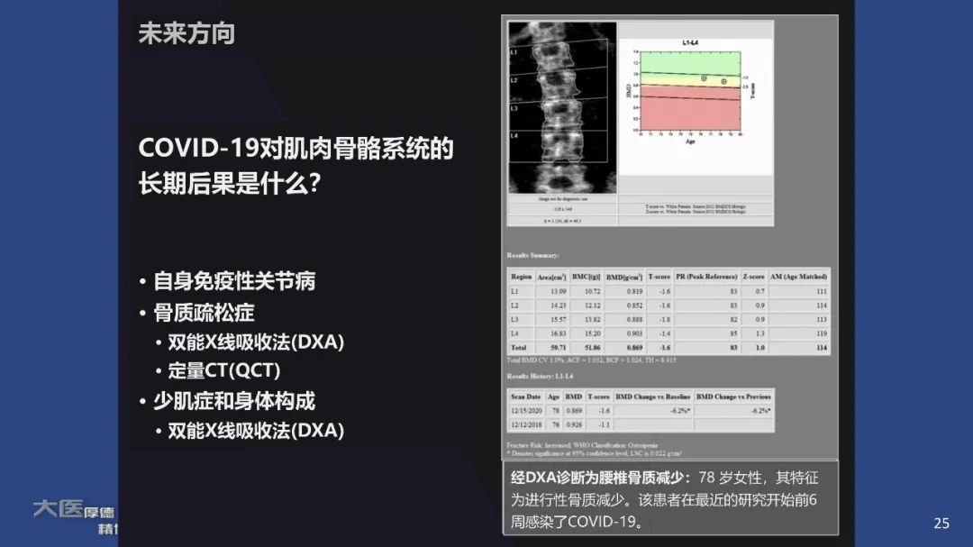 【PPT】COVID-19 的肌肉骨骼表现：对目前所描述的多模态成像及临床症状的图片综述​-23