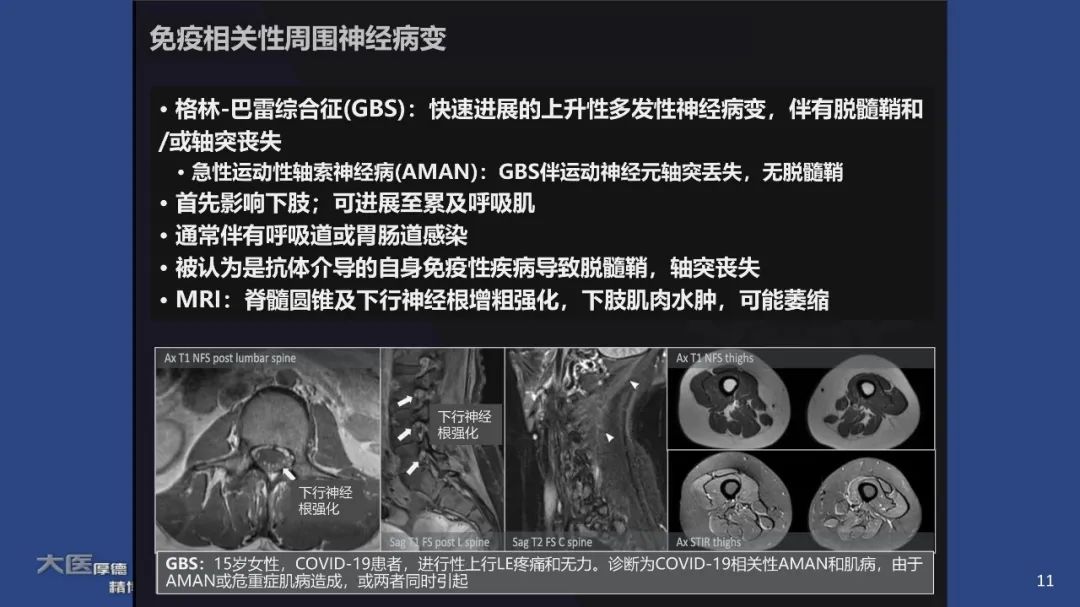 【PPT】COVID-19 的肌肉骨骼表现：对目前所描述的多模态成像及临床症状的图片综述​-9